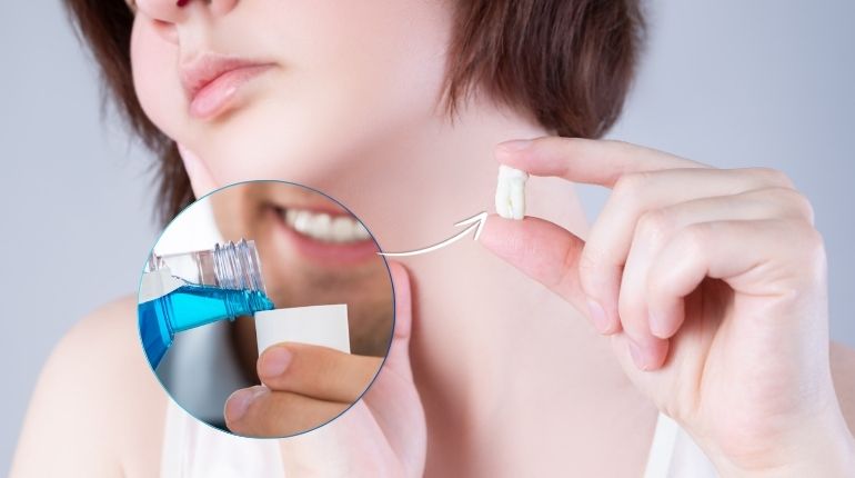 Can I Use a Mouth Cleaner After Wisdom Tooth Extraction?