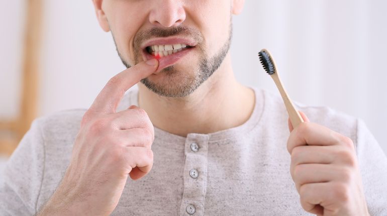 What to Do If Tooth Bleeding While Brushing